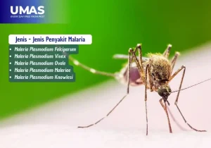 jenis penyakit malaria